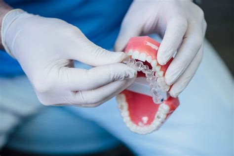  Polimetilmetacrilato: Desvendando o Potencial deste Material em Próteses Dentárias e Implantes Oftalmológicos!